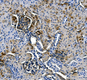 Anti-ASS1 Antibody (monoclonal, 5I5)