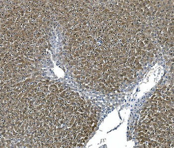 Anti-ASS1 Antibody (monoclonal, 5I5)