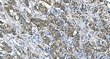 ASS1 Antibody (monoclonal, 7I9)