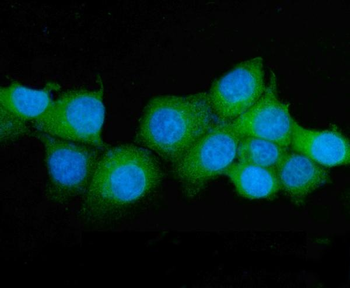 Anti-ASS1 Antibody (monoclonal, 7I9)