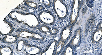 Anti-ASS1 Antibody (monoclonal, 7I9)