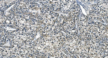 Anti-ASS1 Antibody (monoclonal, 7I9)