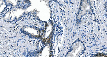 Anti-ASS1 Antibody (monoclonal, 7I9)