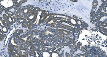Anti-eRF1/ETF1 Antibody (monoclonal, 3B6)
