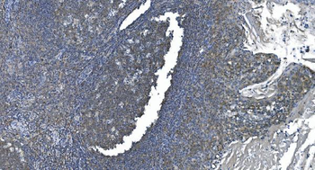 Anti-eRF1/ETF1 Antibody (monoclonal, 3B6)