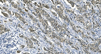 Anti-eRF1/ETF1 Antibody (monoclonal, 3B6)
