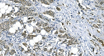 Anti-eRF1/ETF1 Antibody (monoclonal, 3B6)