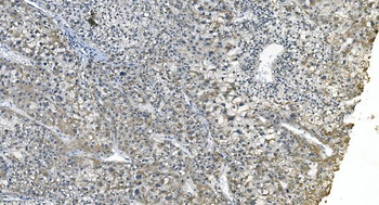 Anti-eRF1/ETF1 Antibody (monoclonal, 3B6)