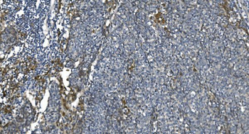 Anti-eRF1/ETF1 Antibody (monoclonal, 3B6)