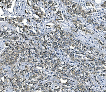 Anti-eRF1/ETF1 Antibody (monoclonal, 3E5)