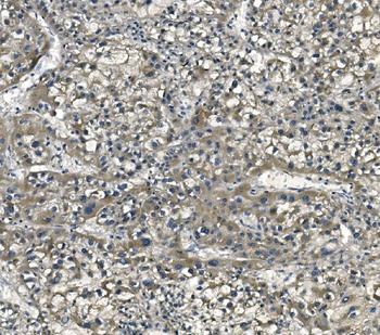Anti-eRF1/ETF1 Antibody (monoclonal, 3E5)