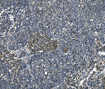 Anti-eRF1/ETF1 Antibody (monoclonal, 3E5)