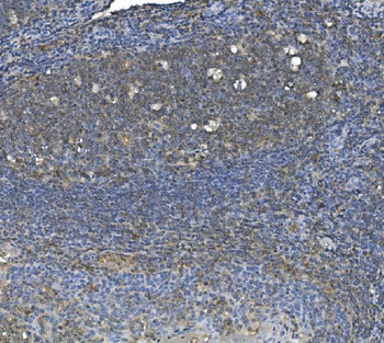 Anti-eRF1/ETF1 Antibody (monoclonal, 3E5)