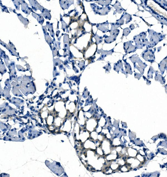 Anti-eRF1/ETF1 Antibody (monoclonal, 3E5)