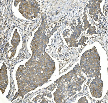 EEF2 Antibody (monoclonal, 5F5)