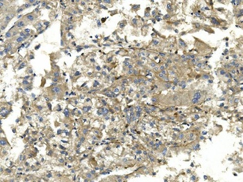 EEF2 Antibody (monoclonal, 5F5)