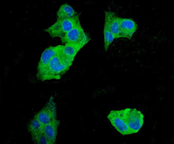 Anti-EEF2 Antibody (monoclonal, 5F5)