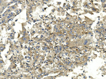 Anti-EEF2 Antibody (monoclonal, 5F5)