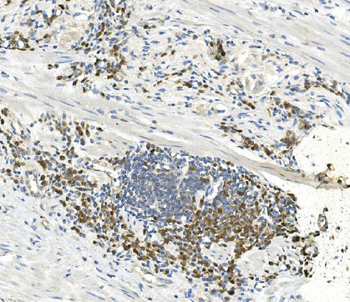 Anti-EEF2 Antibody (monoclonal, 5F5)