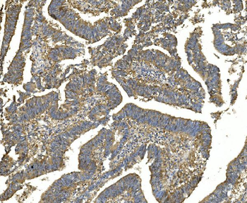 Anti-EEF2 Antibody (monoclonal, 5F5)