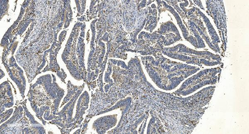 Anti-APPL/APPL1 Antibody (monoclonal, 5G11)