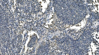 CD13/ANPEP Antibody (monoclonal, 5B9)