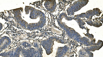 Anti-CD13/ANPEP Antibody (monoclonal, 5B9)