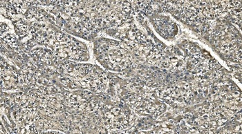 Carbonic Anhydrase I/CA1 Antibody (monoclonal, 4D5)