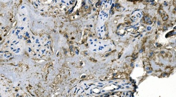 Carbonic Anhydrase I/CA1 Antibody (monoclonal, 4D5)