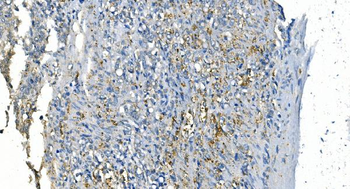Anti-Carbonic Anhydrase I/CA1 Antibody (monoclonal, 2B5)