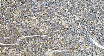 Anti-Carbonic Anhydrase I/CA1 Antibody (monoclonal, 2B5)