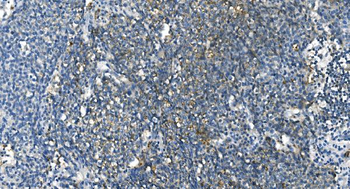 Anti-Carbonic Anhydrase I/CA1 Antibody (monoclonal, 2B5)