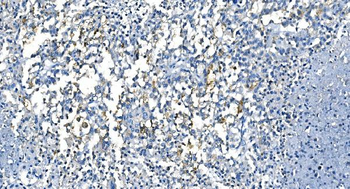 Anti-Carbonic Anhydrase I/CA1 Antibody (monoclonal, 2B5)