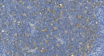 Anti-Carbonic Anhydrase I/CA1 Antibody (monoclonal, 2B5)