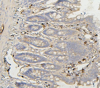 BAK/BAK1 Antibody