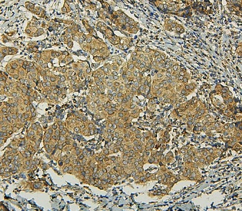 BAK/BAK1 Antibody