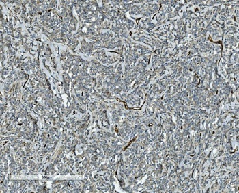 Anti-CD34 Antibody