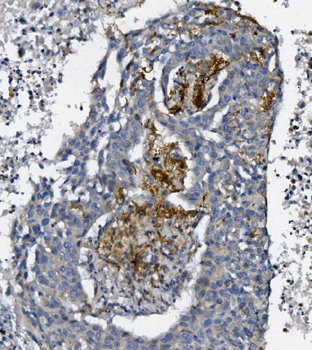Anti-AFAP/AFAP1 Antibody