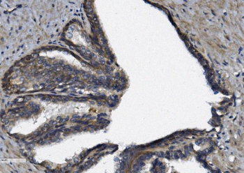 Anti-AFAP/AFAP1 Antibody