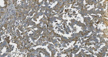 Anti-K Cadherin/CDH6 Antibody