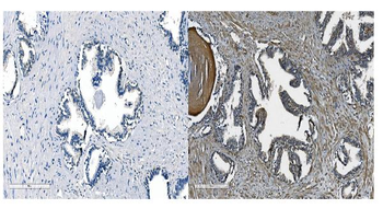 Anti-OB Cadherin/CDH11 Antibody