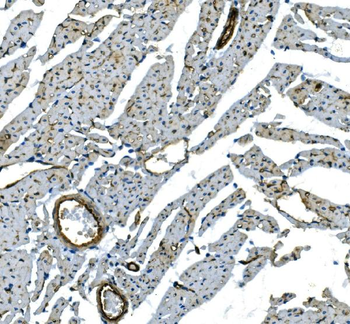 Anti-H Cadherin/CDH13 Antibody