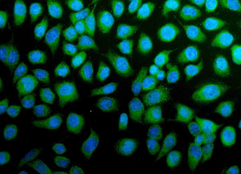Anti-H Cadherin/CDH13 Antibody