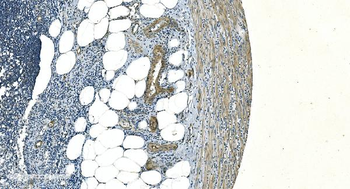 Anti-H Cadherin/CDH13 Antibody