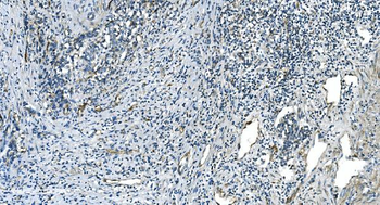 Anti-H Cadherin/CDH13 Antibody