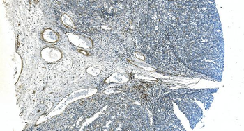 Anti-H Cadherin/CDH13 Antibody
