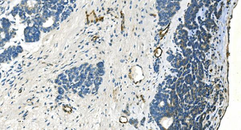 Anti-H Cadherin/CDH13 Antibody