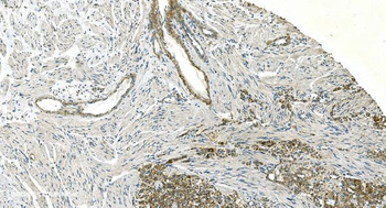 Anti-H Cadherin/CDH13 Antibody