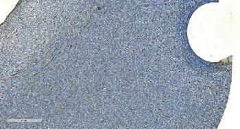 Anti-H Cadherin/CDH13 Antibody