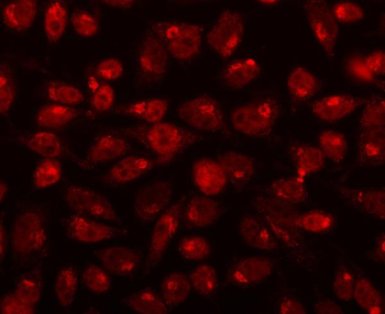 Anti-CDK13 Antibody